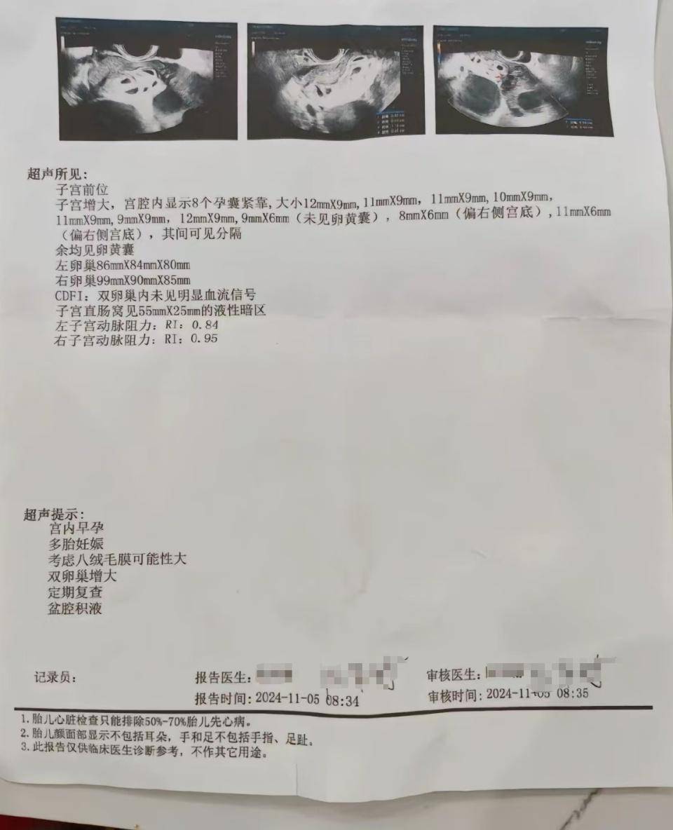 怀上9胞胎女子今日进行减胎手术：分两次进行<strong></p>
<p>货币直接交易</strong>，第一次减去四个胚胎，第二次减去三个