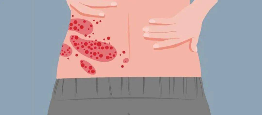 一旦感染终身携带<strong></p>
<p>货币直接交易</strong>!深圳疾控提醒:这4类人要注意