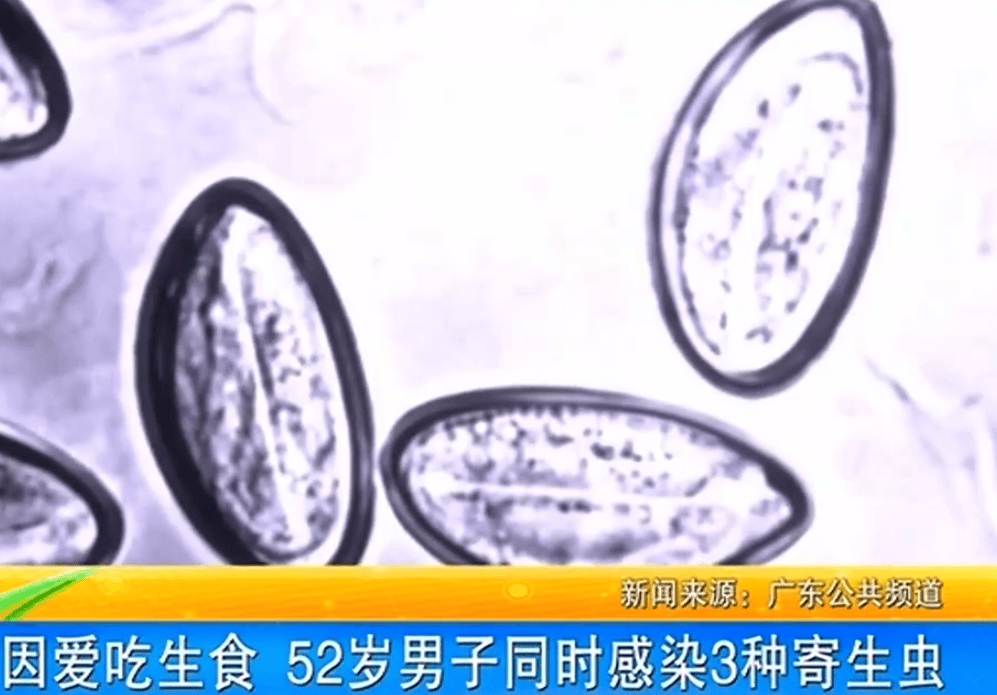 女子体内排出10米长绦虫<strong></p>
<p>债券交易流程</strong>!原是两年前旅游时吃了这种食物