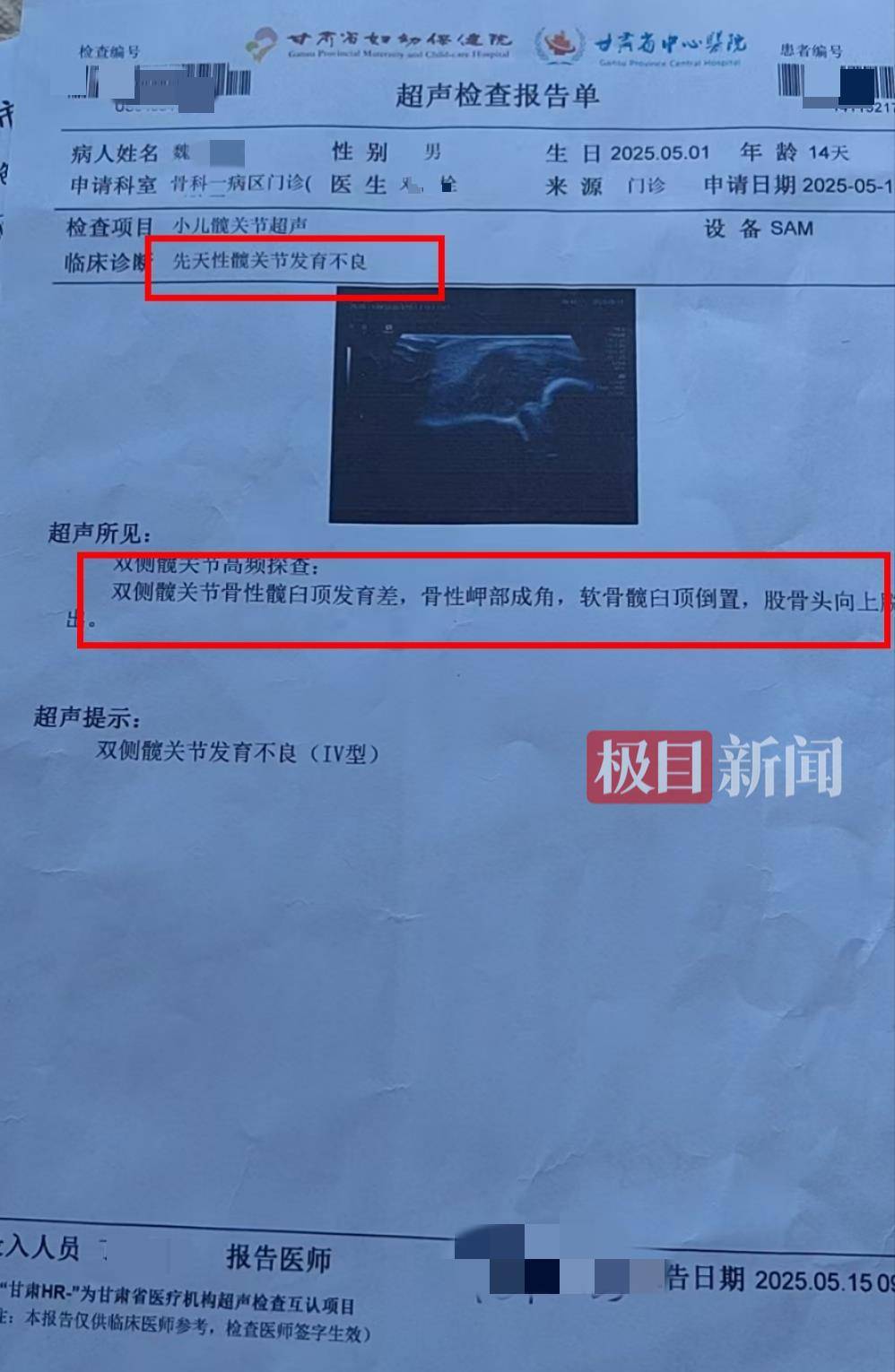 二胎出生查出先天性病症或落下残疾<strong></p>
<p>四五软件</strong>,残疾父母称医院产检漏检、未尽告知义务,医院及医调委回应