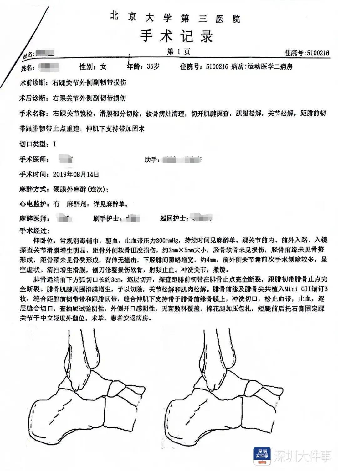 “一走路就痛”!女子脚踝受伤遭漏诊<strong></p>
<p>保证金</strong>,治了7年没好!深圳一医院被告上法庭
