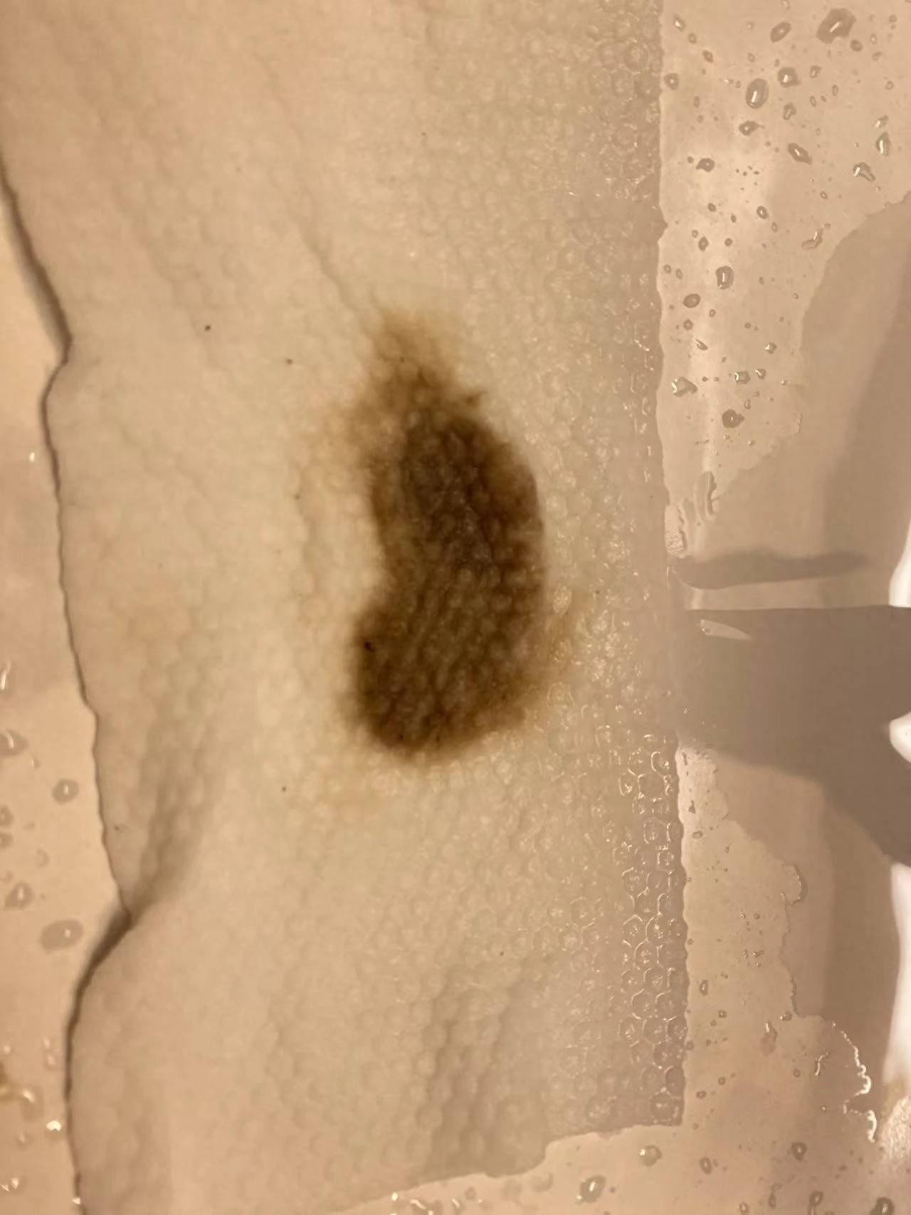 杭州部分小区居民反映自来水发臭<strong></p>
<p>比特儿交易平台打不开</strong>，污染源仍不明