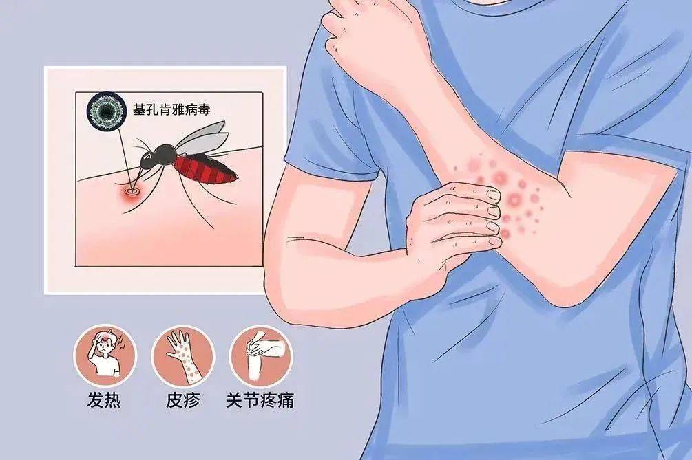 风险增大<strong></p>
<p>比特派</strong>！深圳疾控：去这247处要小心！张文宏首次发声