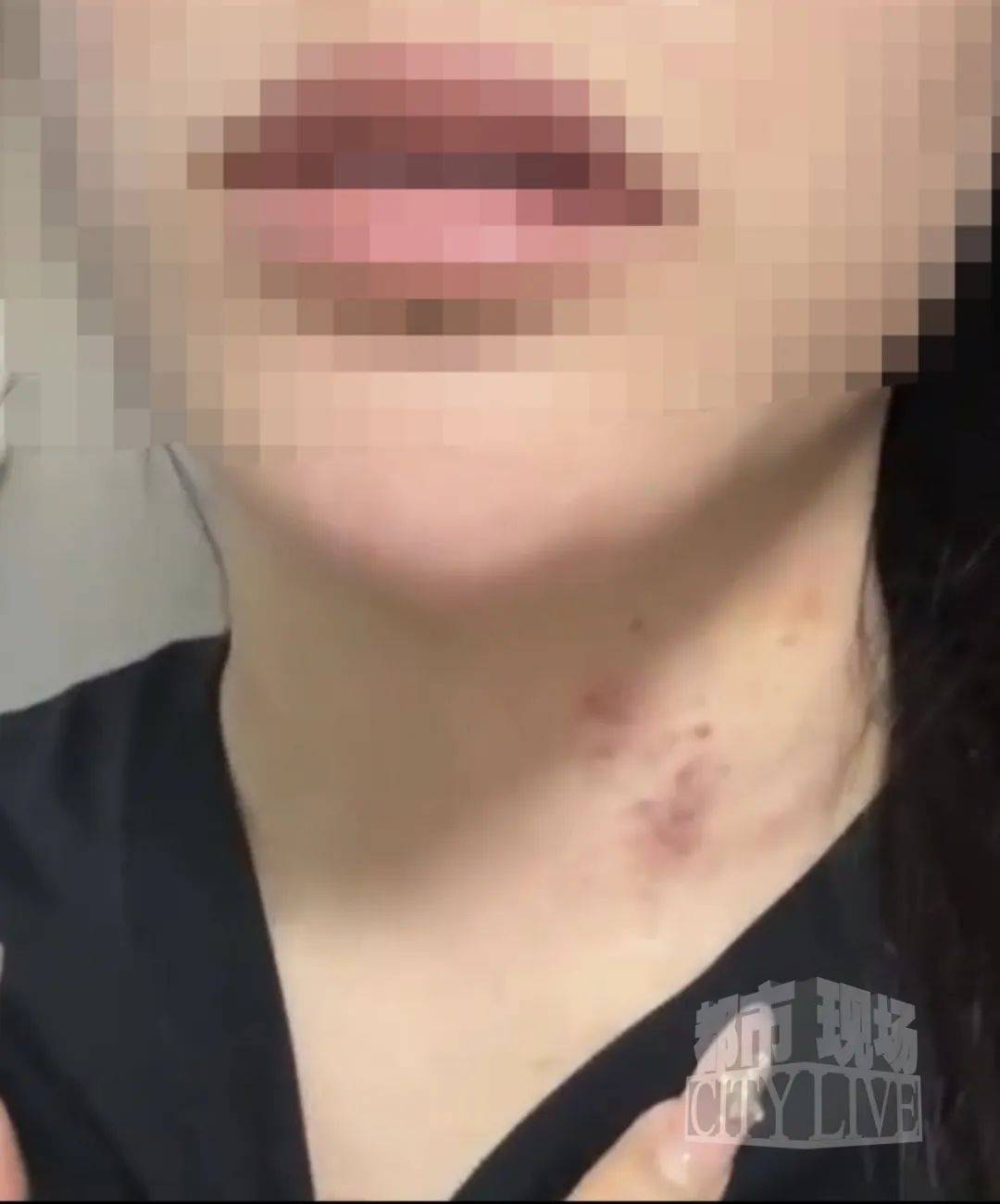 湖南衡阳29岁女子疑被男友施暴后从25楼跳下身亡 男友徐某此前还刺激说:“你放心<strong></p>
<p>比特派新钱包</strong>,她不会去死的”