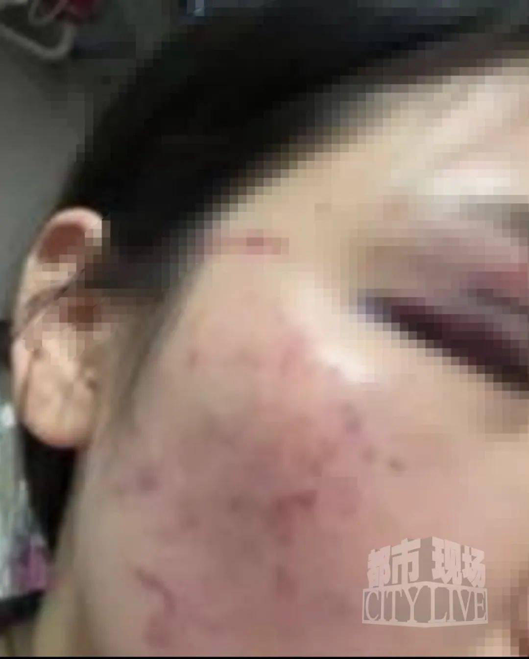 湖南衡阳29岁女子疑被男友施暴后从25楼跳下身亡 男友徐某此前还刺激说:“你放心<strong></p>
<p>比特派新钱包</strong>,她不会去死的”