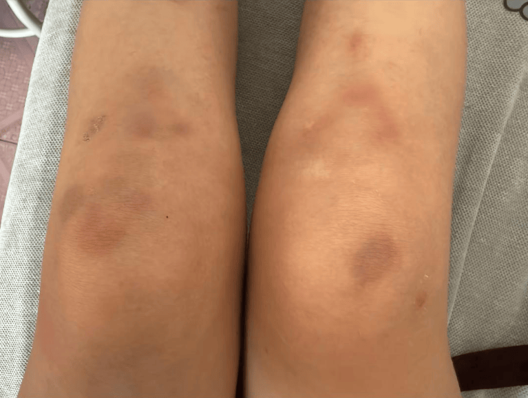 女子自称因工资问题被老板锁办公室里打 警方：双方已到派出所<strong></p>
<p>币安老板</strong>，是否打人还在调查