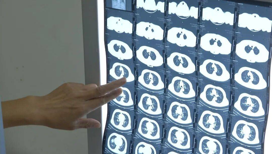 许多患者没有症状<strong></p>
<p>币安注册</strong>,发病就猝死!警惕这种心脏疾病