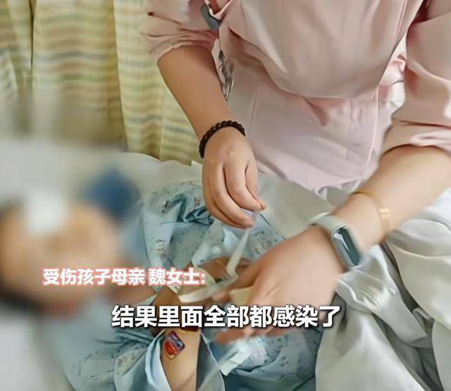 江西一5岁男孩在幼儿园被戳伤致左眼失明<strong></p>
<p>币安官网下载</strong>，家长称老师用猪油涂抹试图消肿