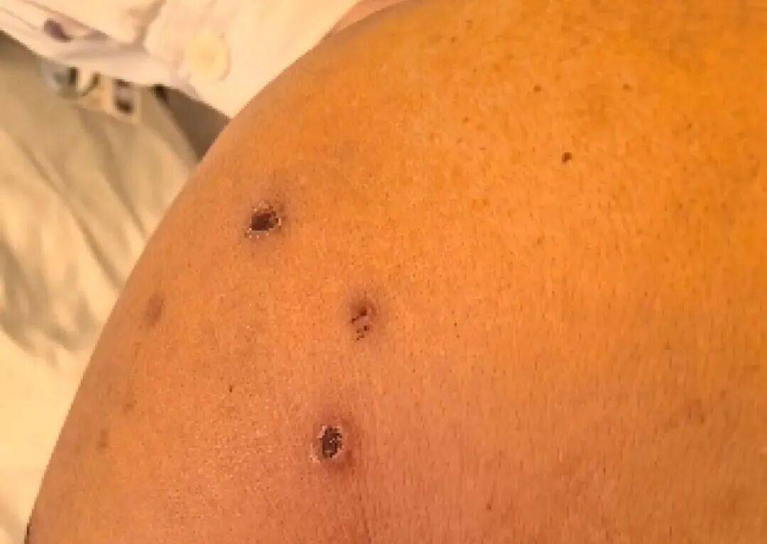 深圳一市民突遭马蜂围袭!已进入高发期<strong></p>
<p>币安官网入口</strong>,千万别招惹!