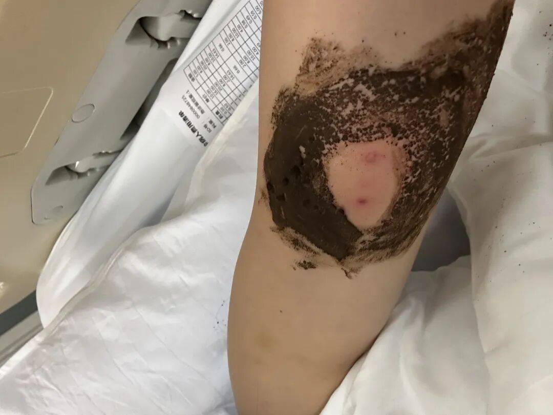 4名游客景区内遭马蜂袭击<strong></p>
<p>币安官网入口</strong>，旅游度假区：是森林公园不卖门票，蜇伤先就医后提供证据投诉