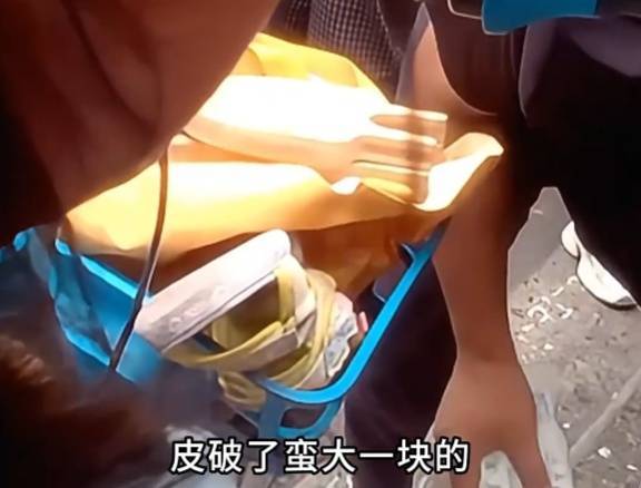 看着都疼<strong></p>
<p>币安网站</strong>！上海街头一男子突然求助：10岁女儿被死死卡住！这个行为太危险→
