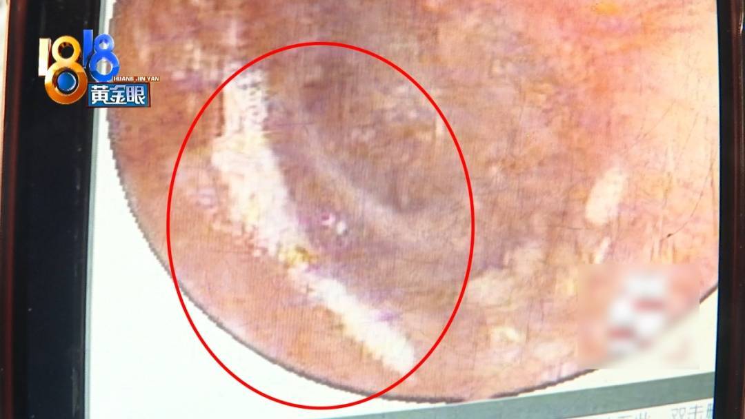 杭州姑娘痒了一整夜<strong></p>
<p>BLUR币</strong>,检查结果让她崩溃……浴场回应索赔:凭什么要两千?