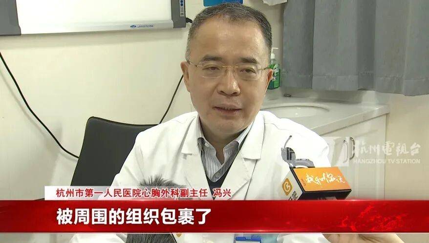 17岁小伙参军体检发现胸腔内有根5cm缝衣针<strong></p>
<p>偿债基金系数</strong>,父母回忆或是1岁时扎入,取出时已锈迹斑斑